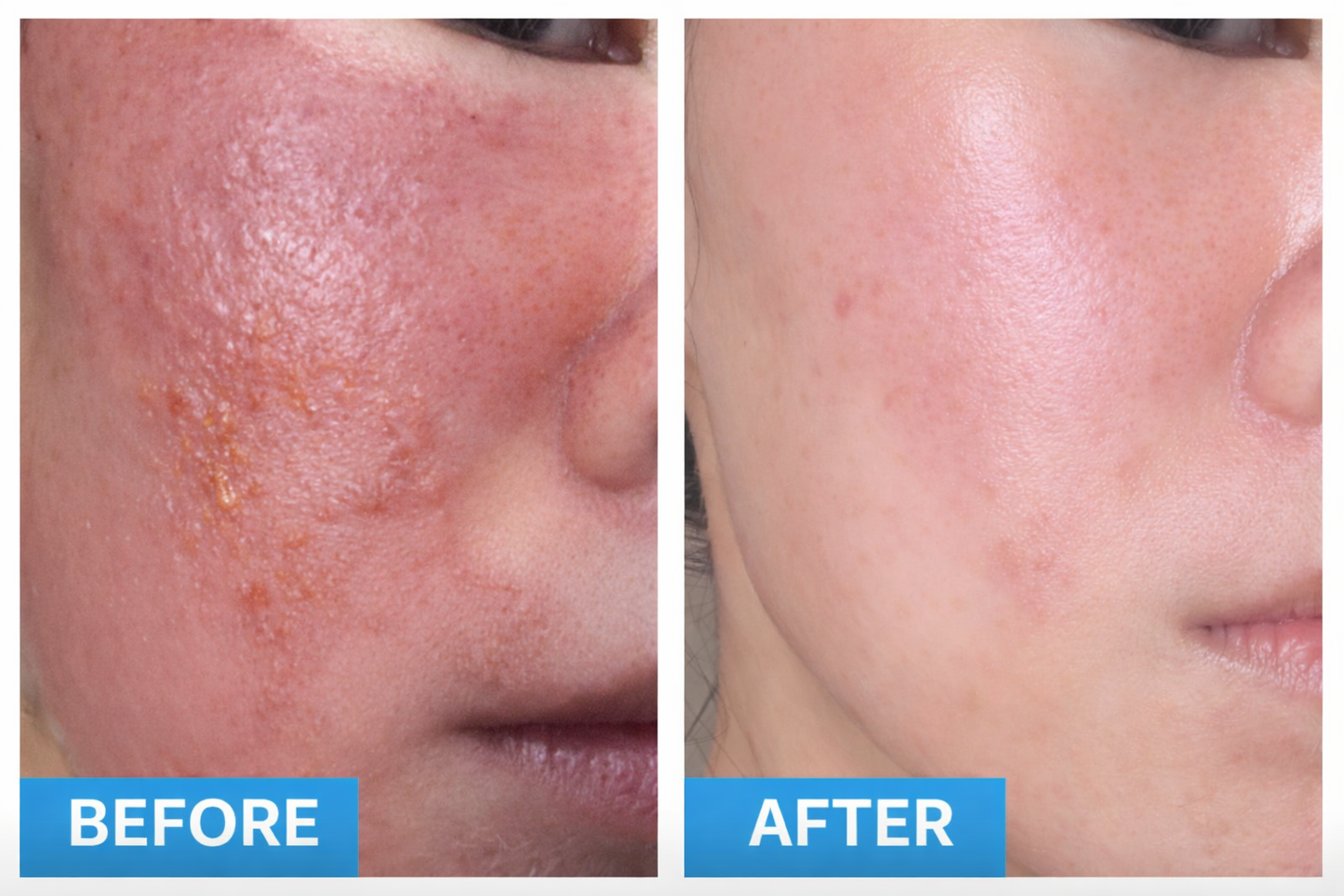 BLUELAB™ Sensitive Skin Moisturizer Fragrance Free (50ml)