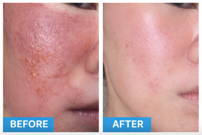 BLUELAB™ Sensitive Skin Moisturizer Fragrance Free (50ml)